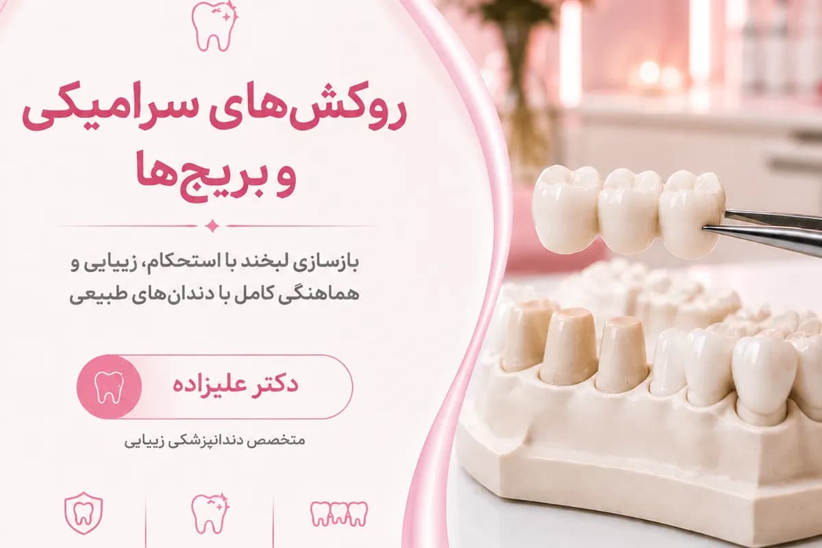 روکشهای سرامیکی و بریجها