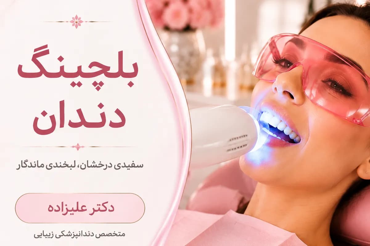 بیلچینگ دندان