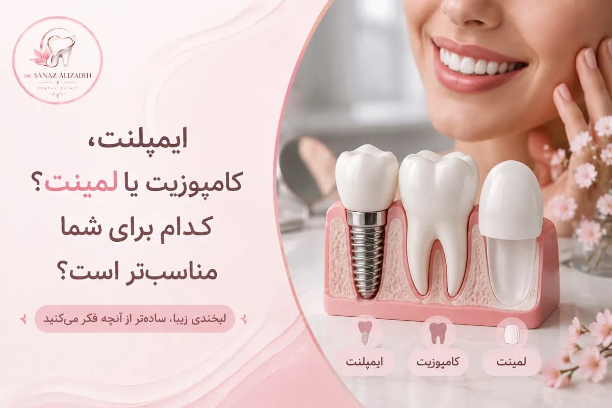 ایمپلنت، کامپوزیت یا لمینت؟ کدام برای شما مناسبتر است؟