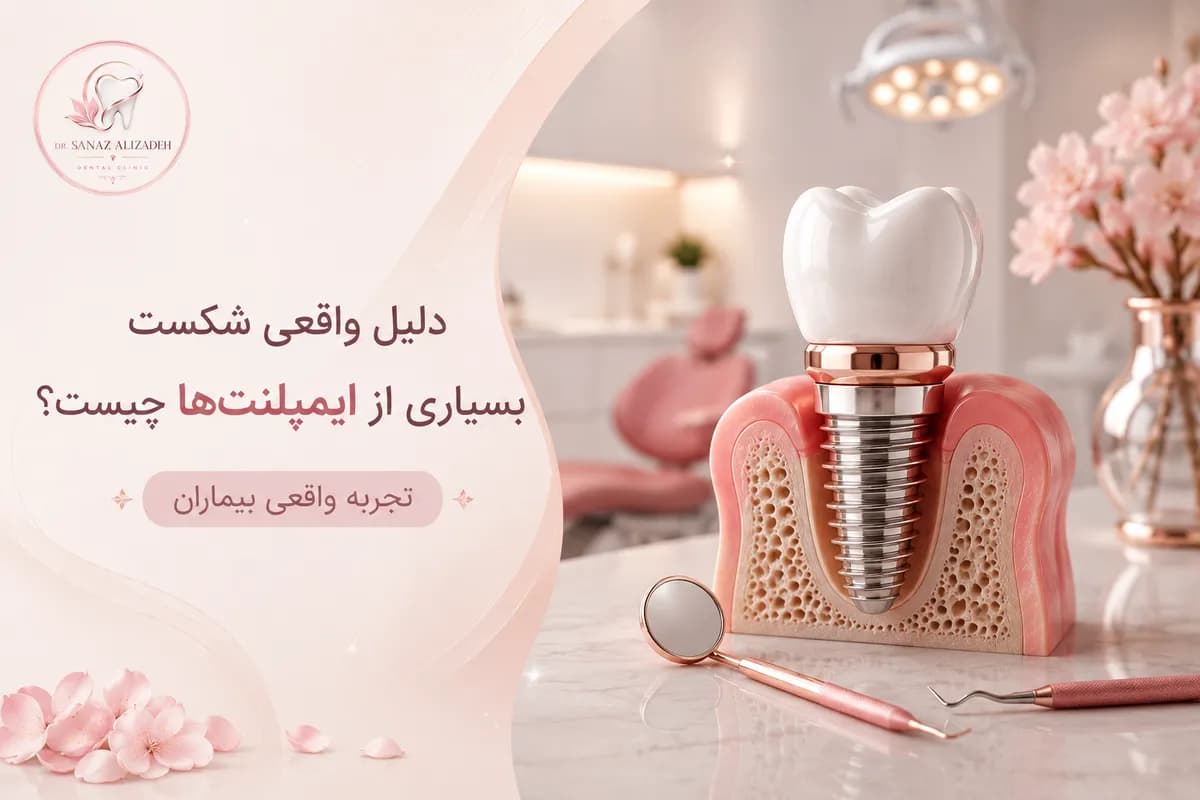 دلیل واقعی شکست بسیاری از ایمپلنتها چیست؟ تجربه واقعی بیماران