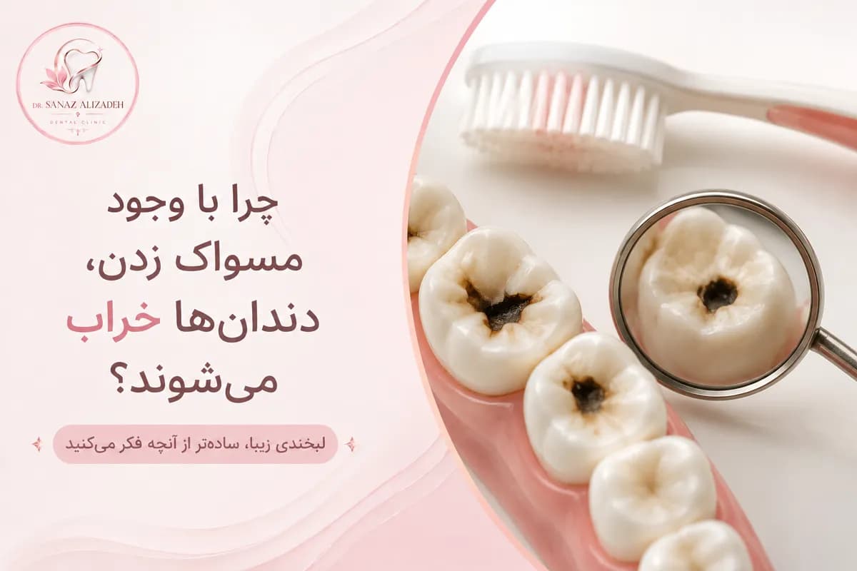 چرا با وجود مسواک زدن، دندانها خراب میشوند؟